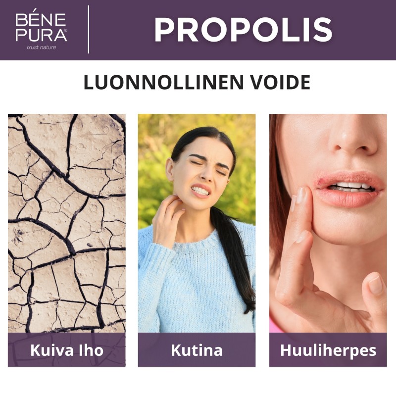 3x Voide Kutinaan kanssa 30% Propolis - 40ml