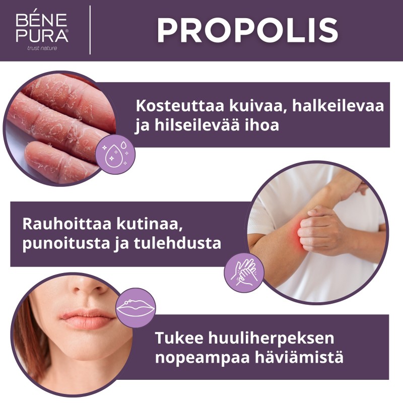 3x Voide Kutinaan kanssa 30% Propolis - 40ml