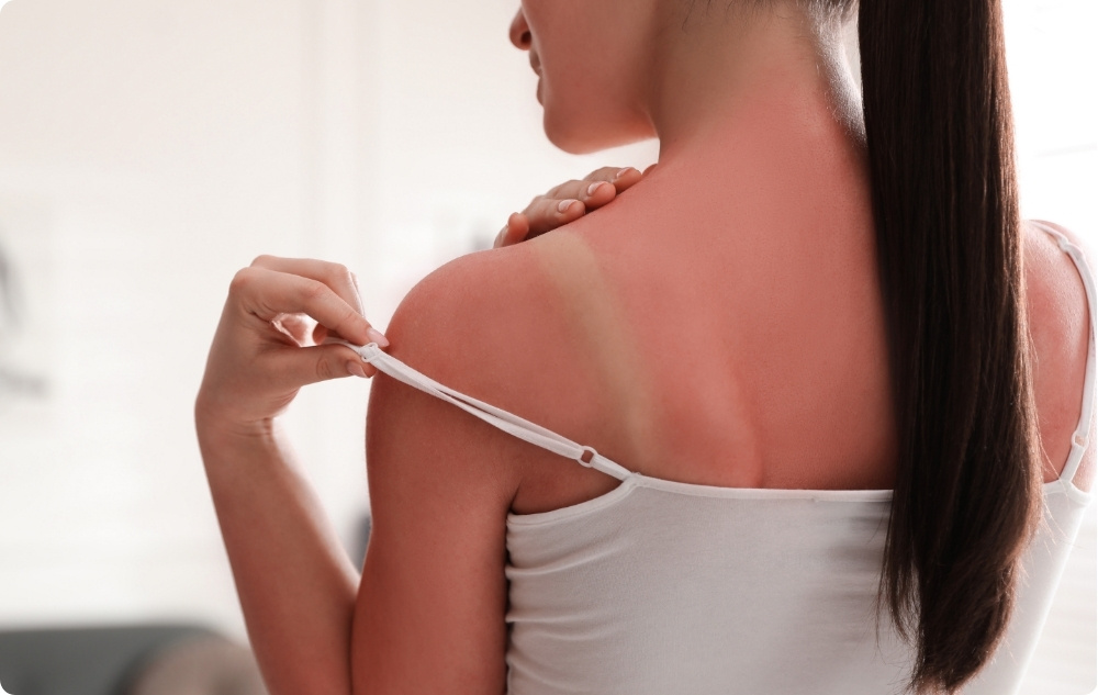 Rauhoittavana aurinkovoiteena